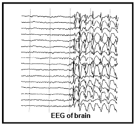 EEG and ECG: Human Health and Diseases - Additional Study Material for ...