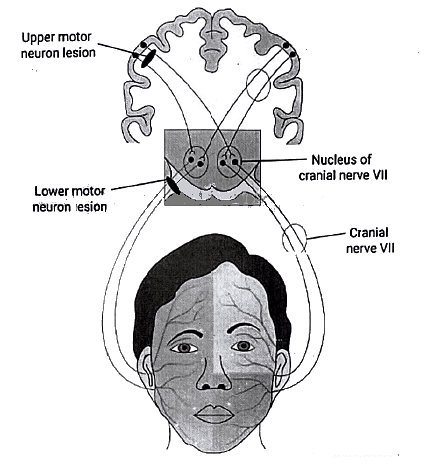 Facial Nerve: Neuroanatomy - Medical Science Optional Notes for UPSC ...