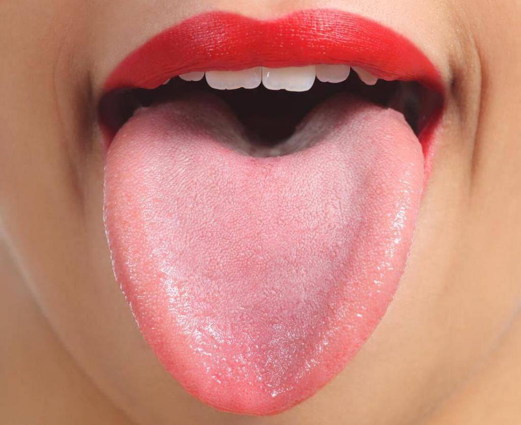 Tiny bumps on tongue
