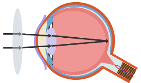 The Eye 10 - Wikipedia