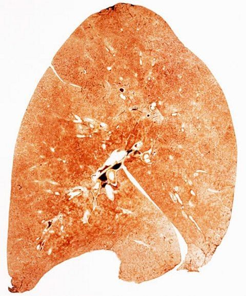 The Effect Of Asthma, Smoking And Exercise On The Gas Exchange System 