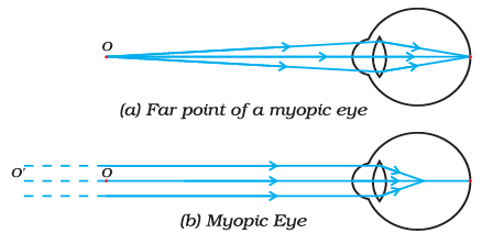 Diagram Based Questions: The Human Eye and the Colourful World - Class ...