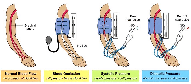 Fig: Measuring Blood Pressure Using a Sphygmomanometer