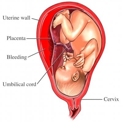 Placenta