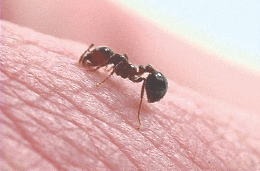 Ant Sting