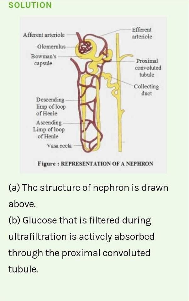 Draw neatly the structure of nephron and label it. - Brainly.in