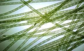 Why Spirogyra Has Spiral Chloroplasts ? - Scholars Ark