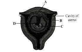 A,B,C,D),("Placental villi","Yolk sac ...